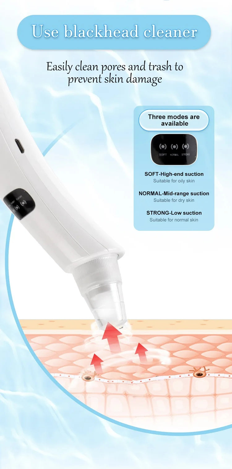 Electric Blackhead Remover – 5-in-1 Rechargeable Pore Vacuum for Clear, Smooth Skin