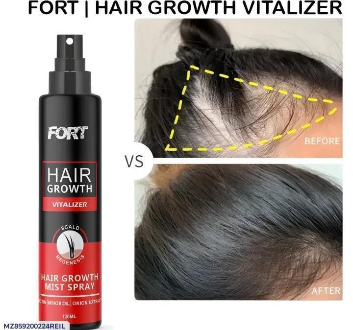 FORT Minoxidil Hair Growth Spray – Hair Tonic for Stronger, Thicker Hair (All Hair Types)