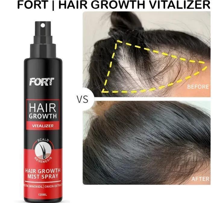 FORT Minoxidil Hair Growth Spray – Hair Tonic for Stronger, Thicker Hair (All Hair Types)